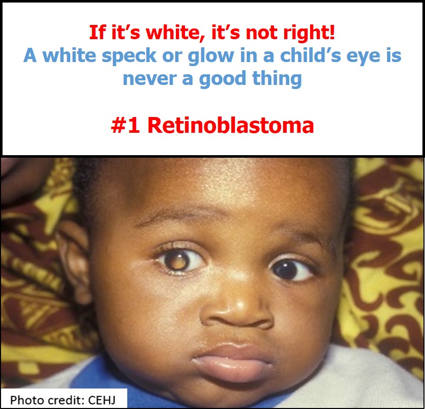 Retinoblastoma Awareness Week 2019 (May 12 -18)